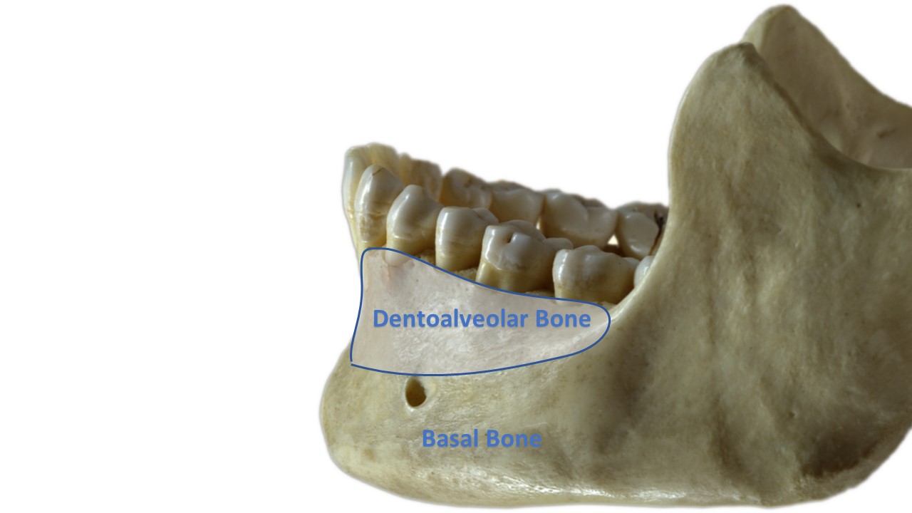 basal implants cost