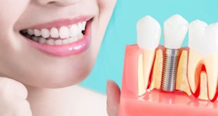 teeth in an hour