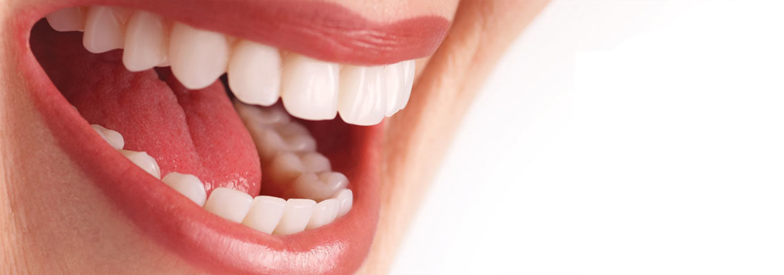 Affordable full mouth dental implants