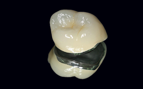 metal free zirconia crown
