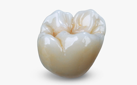 Zirconia Crown