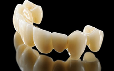 Zirconia Crown