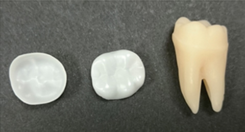 Zirconia Crown over PFM