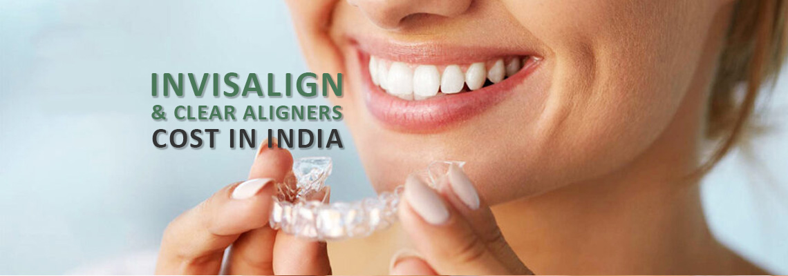 Invisalign & Clear Aligners Cost in India