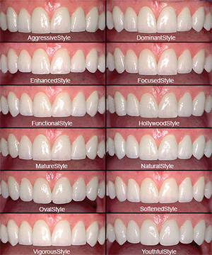 Guide for Smile Makeover