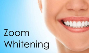 Zoom teeth whitening