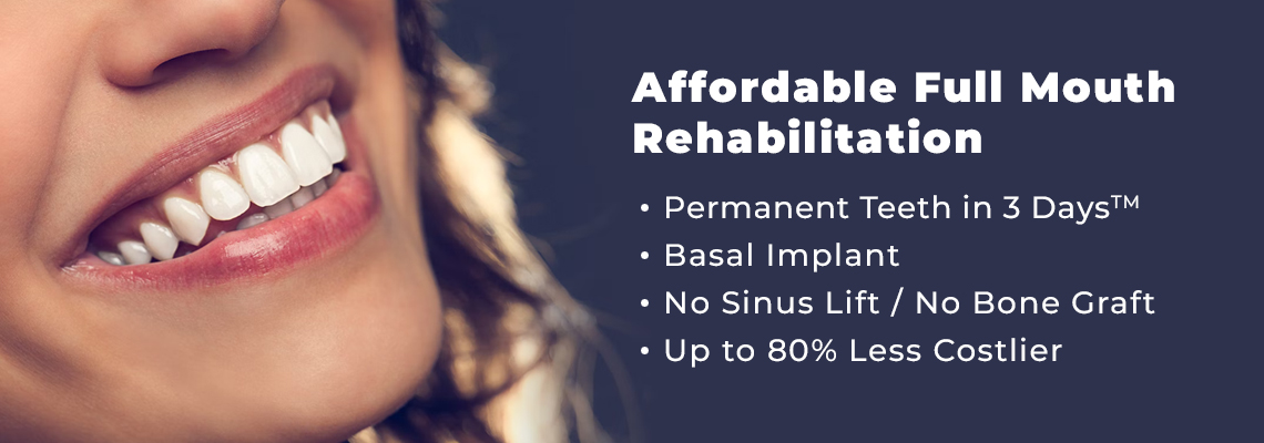 Affordable Full Mouth Rehabilitation