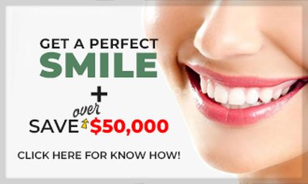 Dental Implant Offer