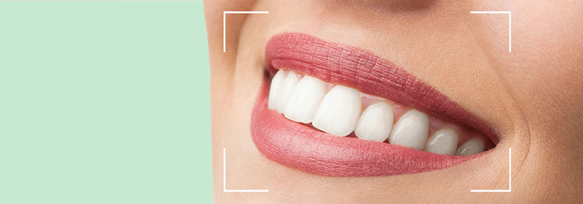 Read more about the article Do’s and Don’ts for a Hollywood Smile