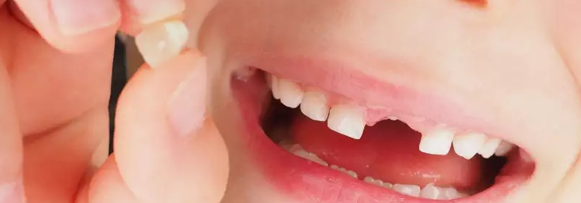 Read more about the article Consequences of Tooth Loss