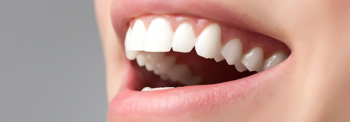 How Many Teeth Can Dental Implants Replace?