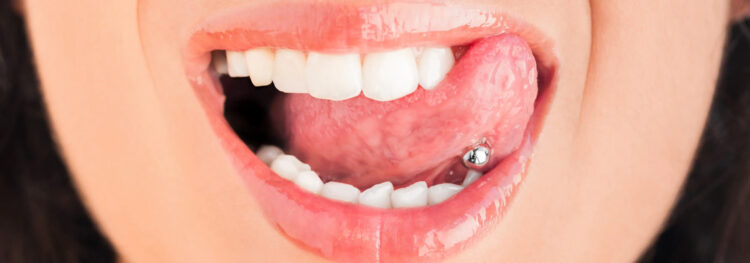 Oral Piercings: Not So Cool for Teeth