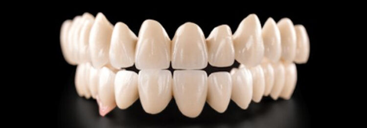Zirconia Crowns: A Game-Changer in Dental Implants