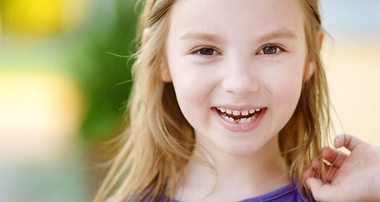 Dental Implants: A Lifelong Solution for Congenitally Missing Teeth
