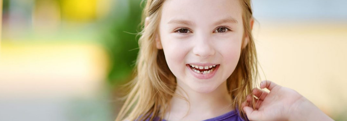 Read more about the article Dental Implants: Best Solution for Congenitally Missing Teeth