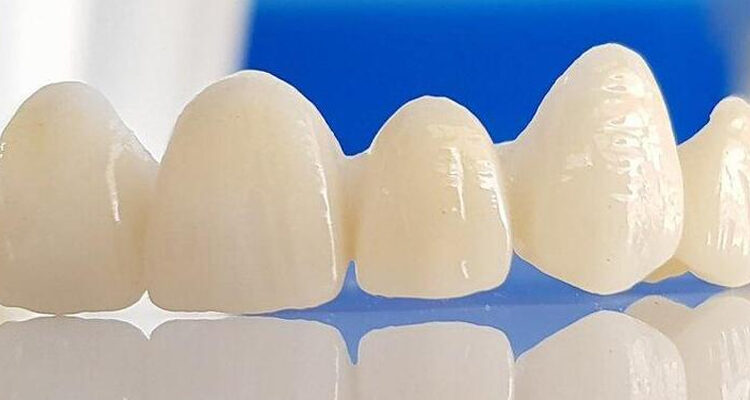Benefits of Zirconia Crowns: A Comprehensive Guide