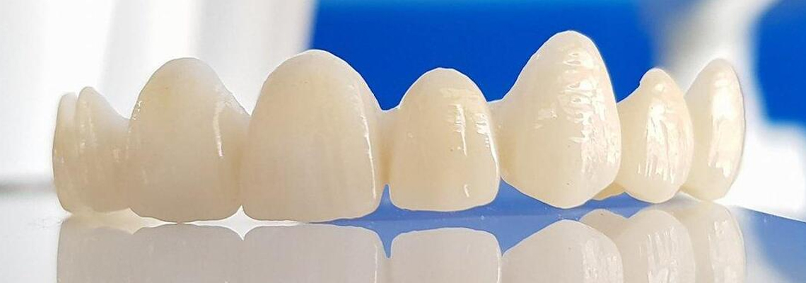 Benefits of Zirconia Crowns: A Comprehensive Guide