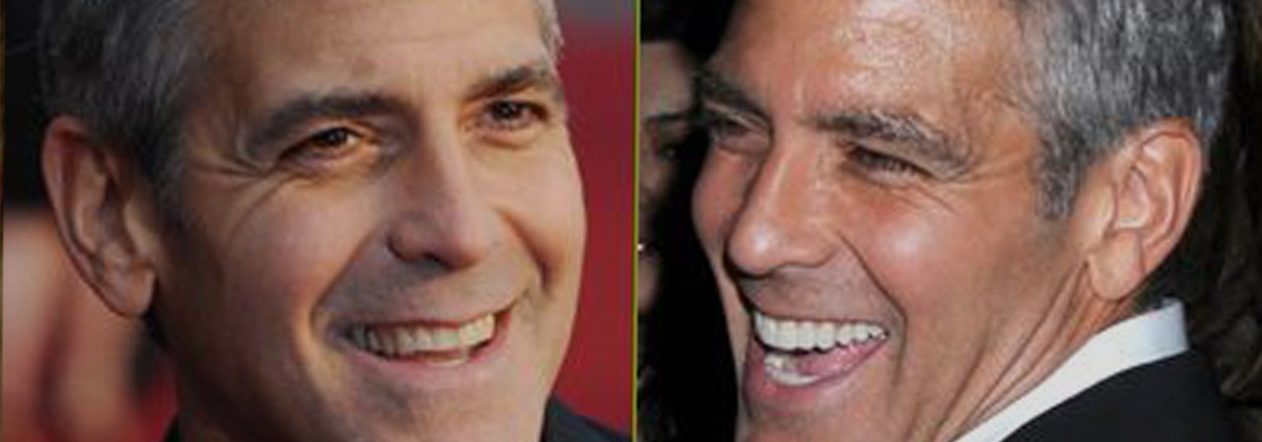Celebrity Smile Secrets: Makeovers You Never Noticed