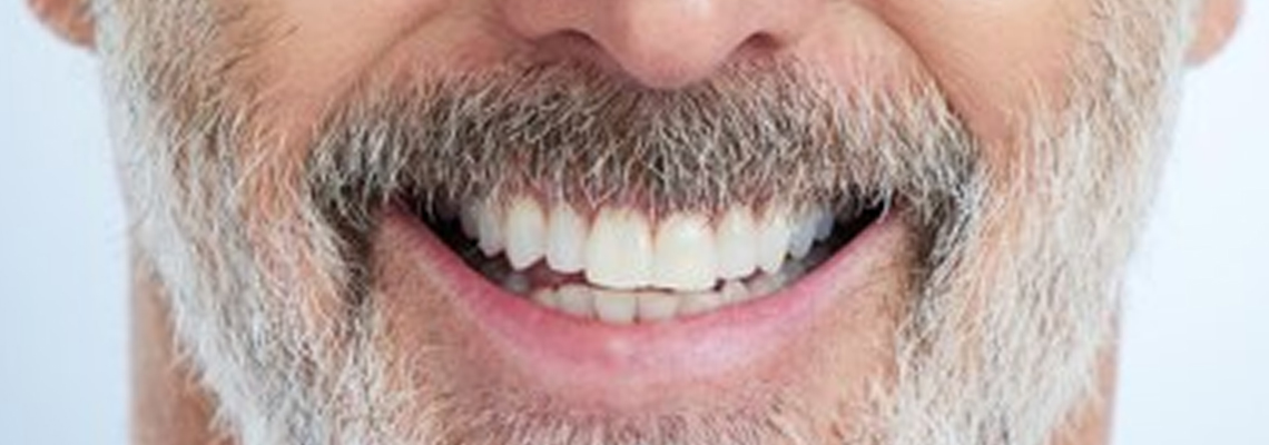 Full Smile Revival in Days, Not Months