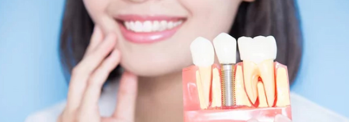 'No Bone' Solution: Basal Implants Work Where There's No Jawbone