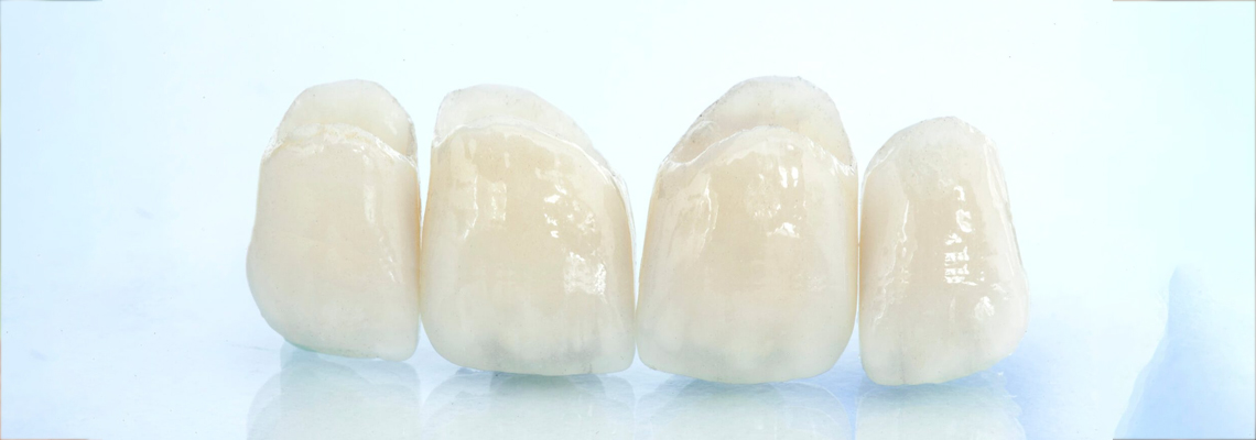 Why Zirconia Crowns Don’t Stain Like Porcelain